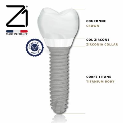 implant france col céramique implant col esthétique